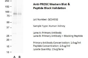 Host: Rabbit Target Name: PROSC Sample Type: Human Kidney  Lane A: Primary Antibody  Lane B: Primary Antibody + Blocking Peptide  Primary Antibody Concentration: 1. (PROSC Antikörper  (C-Term))