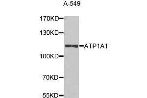 Western blot analysis of extracts of A-549 cells, using ATP1A1 antibody (ABIN5995394) at 1/1000 dilution. (ATP1A1 Antikörper)
