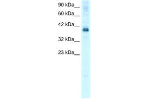 WB Suggested Anti-TSC22D4 Antibody Titration: 0. (TSC22D4 Antikörper  (N-Term))