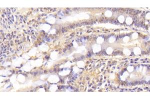 Detection of ST2 in Human Small intestine Tissue using Monoclonal Antibody to Syntenin 2 (ST2) (SDCBP2 Antikörper  (AA 1-292))