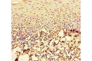 Immunohistochemistry of paraffin-embedded human tonsil tissue using ABIN7167196 at dilution of 1:100 (RAC1 Antikörper  (AA 11-185))
