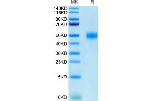 Human CD24 on Tris-Bis PAGE under reduced conditions. (CD24 Protein (AA 27-59) (Fc Tag))