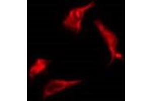 ABIN6277783 staining Hela by IF/ICC. (PERK Antikörper  (pThr982))