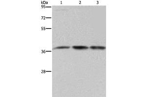 Western Blot analysis of 293T and LoVo cell, Human brain malignant glioma tissue using CAB39 Polyclonal Antibody at dilution of 1:450 (CAB39 Antikörper)