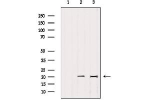 Western Blotting (WB) image for anti-Inner Mitochondrial Membrane Peptidase Subunit 2 (IMMP2L) (Internal Region) antibody (ABIN6262577)