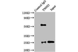 Immunoprecipitating TNNI3 in Rat heart tissue Lane 1: Rabbit control IgG instead of ABIN7173574 in Rat heart tissue. (TNNI3 Antikörper  (AA 2-210))