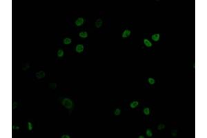 Immunofluorescence staining of HepG2 Cells with ABIN7127457 at 1:50, counter-stained with DAPI.