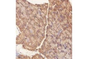 Immunohistochemistry (Paraffin-embedded Sections) (IHC (p)) image for anti-Ribosomal Protein L10 (RPL10) antibody (ABIN7075428)