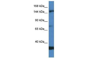 WB Suggested Anti-EIF5B AntibodyTitration: 1. (EIF5B Antikörper  (Middle Region))
