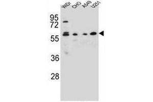 CEP70 Antibody (Center) western blot analysis in WiDr,CHO,A549,U251 cell line lysates (35µg/lane).