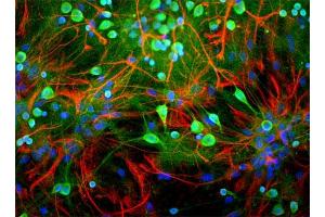 Rat mixed neuron/glial cultures stained with anti-UCHL1 antibody (green) and rabbit anti-GFAP antibody (620-GFAP) (red).