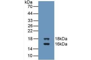 Detection of Recombinant GDF3, Human using Monoclonal Antibody to Growth Differentiation Factor 3 (GDF3) (GDF3 Antikörper  (AA 251-364))