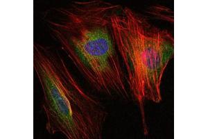 Immunofluorescence analysis of NIH/3T3 cells using MMP9 mouse mAb (green).