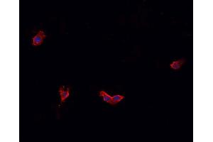 ABIN6269331 staining HeLa cells by IF/ICC. (Caldesmon Antikörper  (C-Term))
