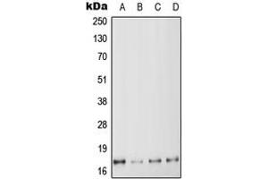 Western blot analysis of MYL6 expression in HeLa (A), K562 (B), SP2/0 (C), H9C2 (D) whole cell lysates. (MYL6 Antikörper  (Center))
