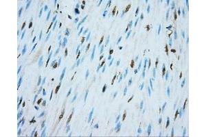 Immunohistochemical staining of paraffin-embedded colon tissue using anti-NIT2 mouse monoclonal antibody. (NIT2 Antikörper)
