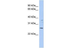 WB Suggested Anti-ASCL2 Antibody Titration:  0. (ASCL2 Antikörper  (Middle Region))