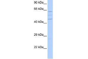 VPS37A antibody used at 1 ug/ml to detect target protein. (VPS37A Antikörper)
