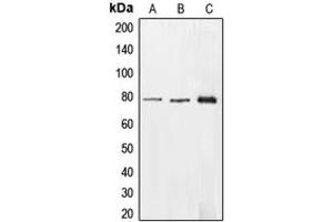 Western blot analysis of EHHADH expression in HepG2 (A), HEK293T (B), A549 (C) whole cell lysates. (EHHADH Antikörper  (Center))