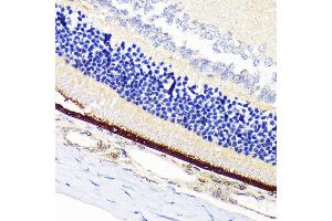 Immunohistochemistry of paraffin-embedded rat retina using RPE65 Rabbit mAb (ABIN7269933) at dilution of 1:100 (40x lens). (RPE65 Antikörper)