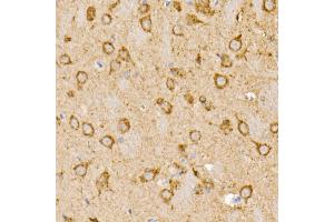 Immunohistochemistry (IHC) image for anti-Prohibitin (PHB) (AA 73-272) antibody (ABIN3020628)