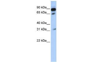 Western Blotting (WB) image for anti-ATP-Binding Cassette, Sub-Family D (Ald), Member 4 (ABCD4) antibody (ABIN2458768)