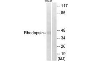 Western blot analysis of extracts from COLO cells, using Rhodopsin (Ab-334) Antibody. (Rhodopsin Antikörper  (AA 299-348))