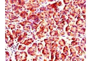 Immunohistochemistry of paraffin-embedded human pancreatic tissue using ABIN7161824 at dilution of 1:100 (NUP85 Antikörper  (AA 201-500))