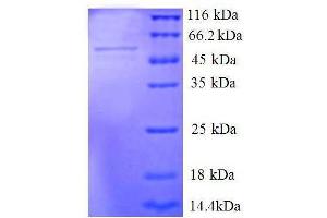 Seryl-tRNA Synthetase (SARS) (AA 2-233), (partial) protein (GST tag) (Seryl-tRNA Synthetase (SARS) (AA 2-233), (partial) protein (GST tag))