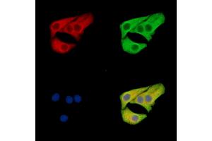 ABIN7096515 and ABIN7100579 staining Hela cells by IF/ICC. (SLC12A6 Antikörper)