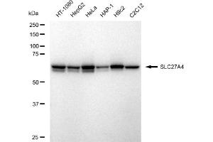 Western blotting analysis using SLC27A4 antibody (ABIN7800392).