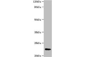 Western blot All lanes: FGF21 antibody at 2 μg/mL + A549 whole cell lysate Secondary Goat polyclonal to rabbit IgG at 1/15000 dilution Predicted band size: 23 kDa Observed band size: 23 kDa (FGF21 Antikörper  (AA 29-209))
