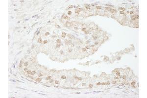 Immunohistochemistry (IHC) image for anti-Chromatin Assembly Factor 1, Subunit B (p60) (CHAF1B) (C-Term) antibody (ABIN7448454) (CHAF1B Antikörper  (C-Term))