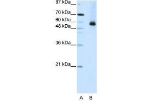 WB Suggested Anti-HNRPL  Antibody Titration: 2. (HNRNPL Antikörper  (N-Term))