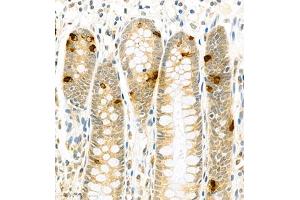 Immunohistochemistry (Paraffin-embedded Sections) (IHC (p)) image for anti-Colony Stimulating Factor 1 (Macrophage) (CSF1) antibody (ABIN7073553)