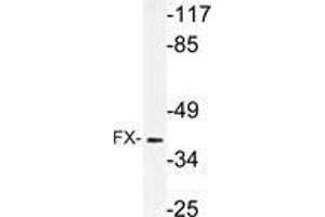 Western blot (WB) analysis of FX antibody in extracts from rat muscle cells.