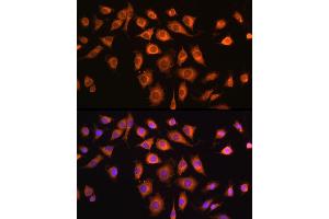 Immunofluorescence analysis of L929 cells using COPZ1 antibody (ABIN6127709, ABIN6138892, ABIN6138893 and ABIN6215734) at dilution of 1:100.