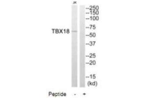 Western blot analysis of extracts from Jurkat cells, using TBX18 antibody. (T-Box 18 Antikörper)