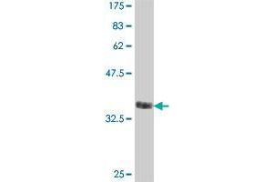 Western Blot detection against Immunogen (38. (TRIM46 Antikörper  (AA 451-560))