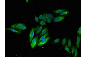 Immunofluorescent analysis of Hela cells using ABIN7156481 at dilution of 1:100 and Alexa Fluor 488-congugated AffiniPure Goat Anti-Rabbit IgG(H+L) (Integrin beta 2 Antikörper  (AA 37-201))