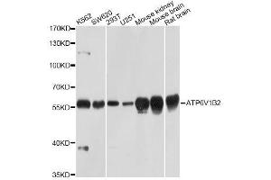 Western blot analysis of extracts of various cell lines, using ATP6V1B2 Antibody. (ATP6V1B2 Antikörper  (AA 262-511))