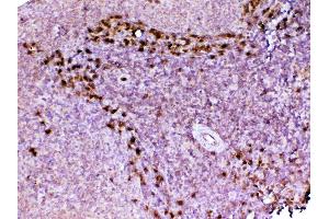 Immunohistochemistry (IHC) image for anti-Adenosine Deaminase (ADA) (AA 2-238) antibody (ABIN5692790)