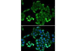 Immunofluorescence analysis of MCF-7 cells using PTS antibody.