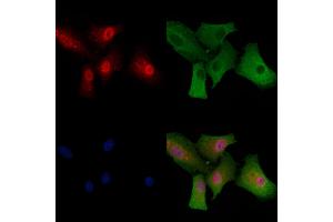 ABIN6260150 and ABIN6279147 staining  cells by IF/ICC.