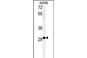 Western blot analysis in A2058 cell line lysates (35ug/lane). (C11orf46 Antikörper  (C-Term))