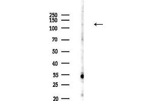 Western blot analysis of lysates from COLO205 cells(heat-shock,45 min treatment), using SELPLG Antibody at 1/1000 dilution.