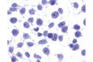 Anti-GPR45 antibody immunocytochemistry (ICC) staining of untransfected HEK293 human embryonic kidney cells. (GPR45 Antikörper  (Cytoplasmic Domain))