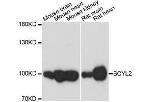 Western blot analysis of extracts of various cell lines, using SCYL2 antibody. (SCYL2 Antikörper  (AA 1-300))