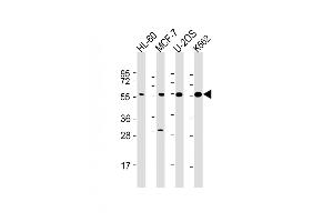 All lanes : Anti-EI2BG Antibody at 1:2000 dilution Lane 1: HL-60 whole cell lysate Lane 2: MCF-7 whole cell lysate Lane 3: U-2OS whole cell lysate Lane 4: K562 whole cell lysate Lysates/proteins at 20 μg per lane. (EIF2B3 Antikörper  (AA 110-452))
