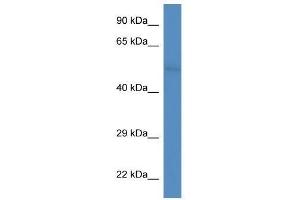 Western Blot showing Fam55d antibody used at a concentration of 1. (FAM55D Antikörper  (C-Term))